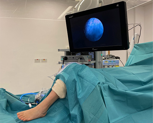 Ankle arthroscopy setup