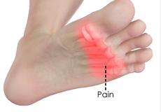 Forefoot Pain